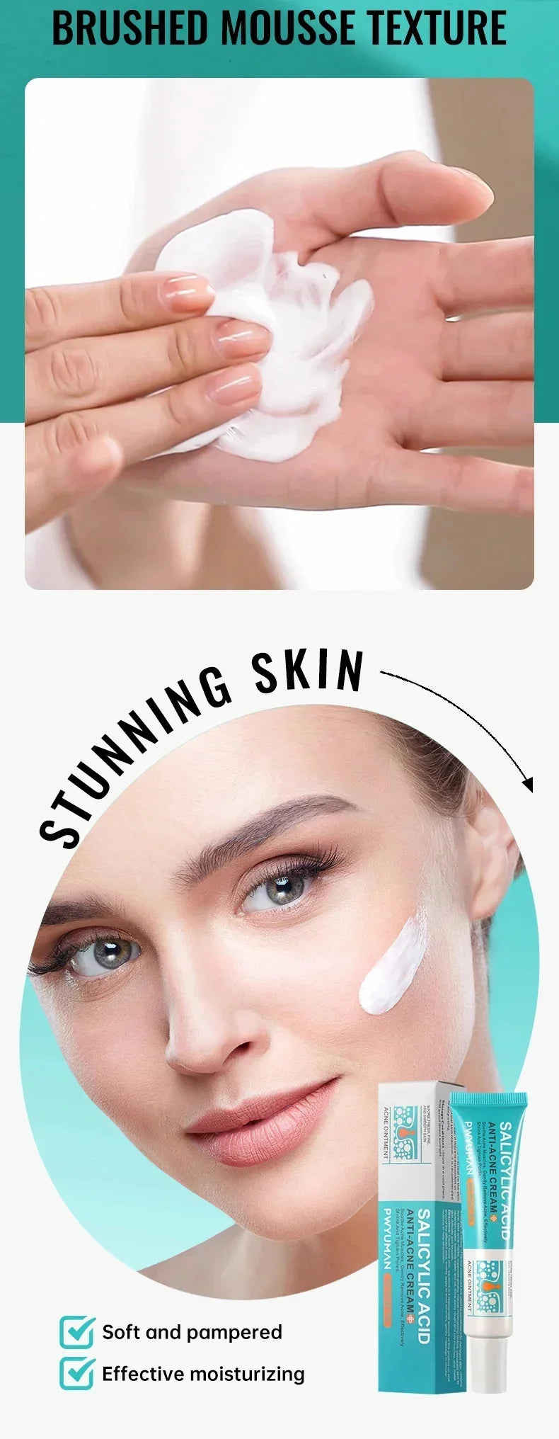 PWYUMAN Salicylic Acid Anti-Acne Cream – Oil Control, Scar Repair & Moisturizer (30ml)